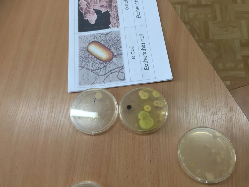 Płytki Petriego z koloniami bakterii obok ilustracji E. coli